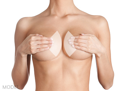 The new 'Internal Bra' – the future of breast surgery or a step too far? -  Let's Talk Breasts