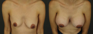 Patient 19 B&A 2