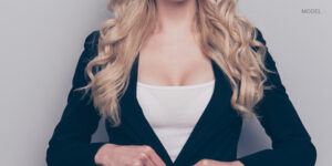 Woman in work clothes   breast revision model | lavinia k chong m D