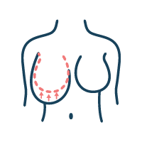 Icon of breast asymmetry