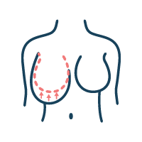 Icon of breast asymmetry | lavinia k chong m D